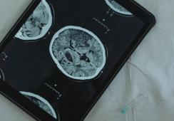 Exploring the Connection Between Neuroscience and AI